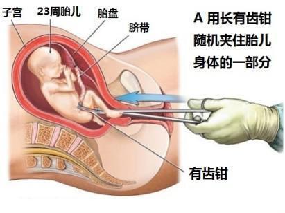 关于三个月流产后的恢复与同房时间的研究