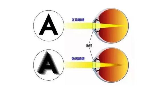 六个月婴儿眼睛散光，成因、影响与应对策略