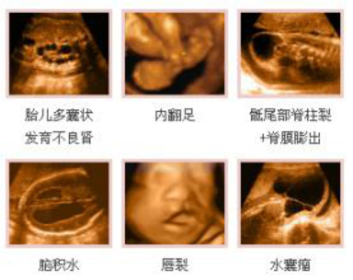 澳门知识专家为您解读，关于胎儿四维彩超的六个月观察期